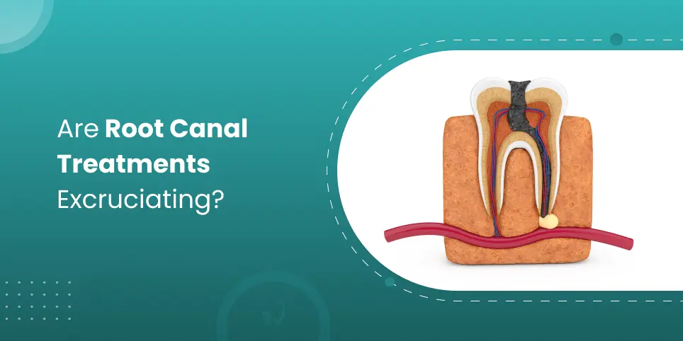 Are Root Canal Treatments Excruciating?