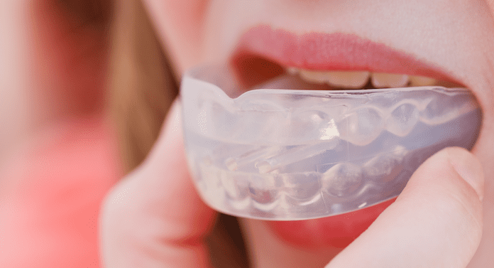 Mouth Guards