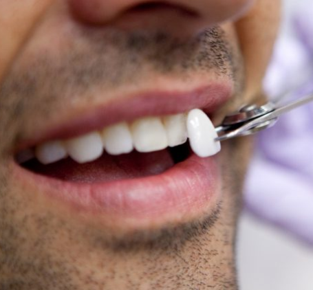 Teeth Grinding TMJ Disorder