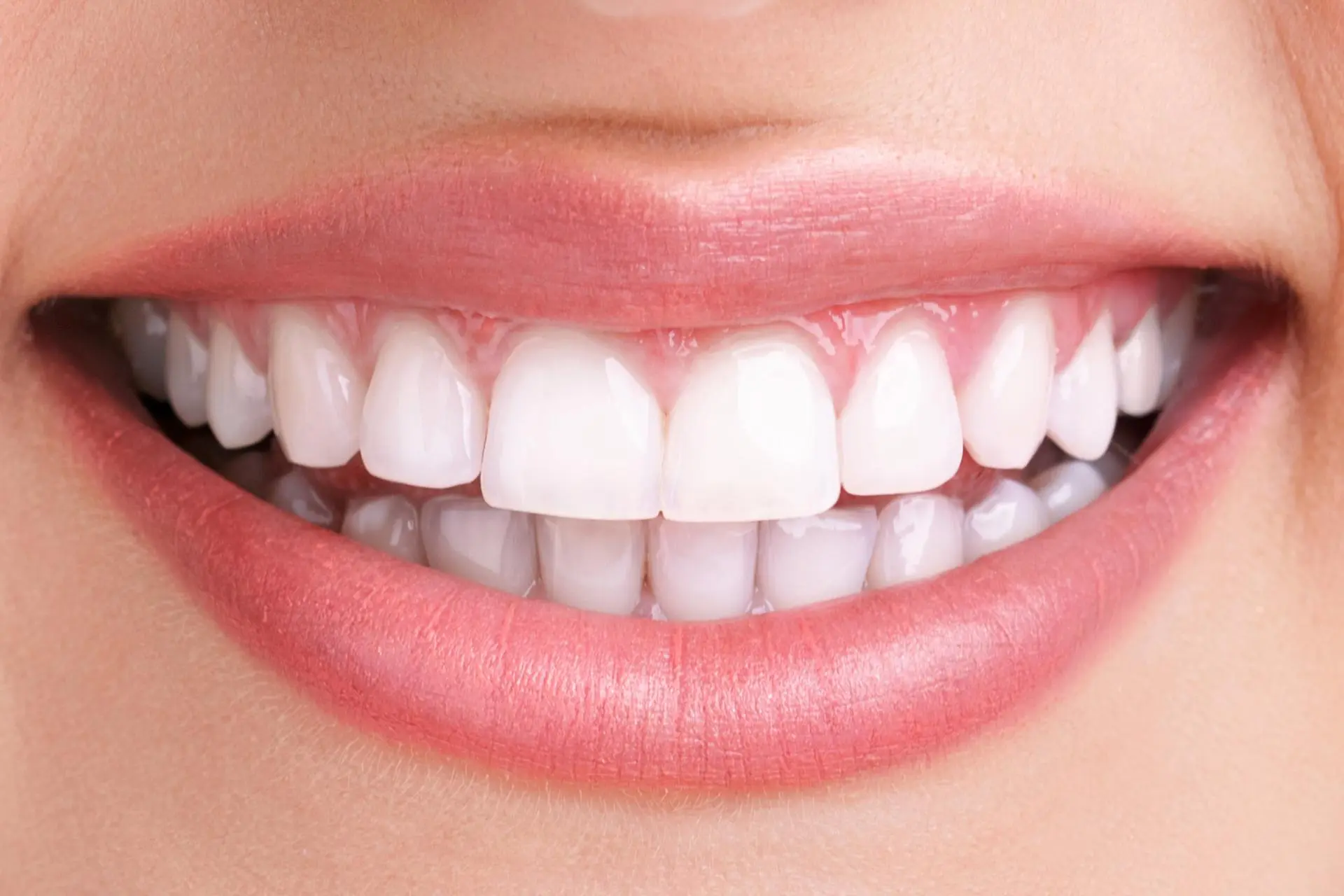 Advantages of Getting a Zirconia Crown