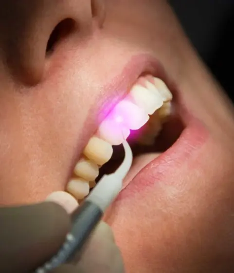 laser dentistry